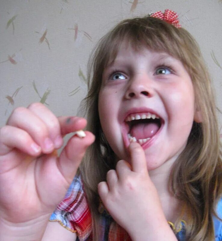 Как выглядит выпавшее. Как выглядит выпавшее. Как выглядит выпавшее. У ребенка выпадает молочный зуб. Выпавший молочный резец.