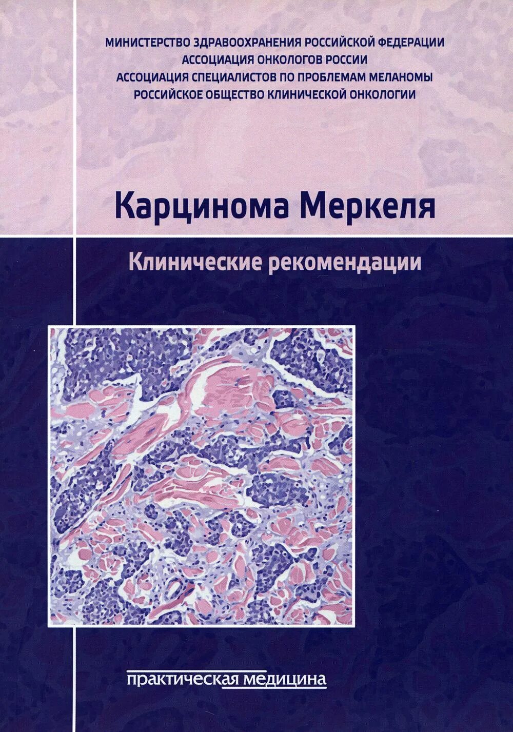 Карцинома Меркеля клинические рекомендации. Клинические рекомендации онкология. Карцинома Меркеля фото и описание. Книги опухоль