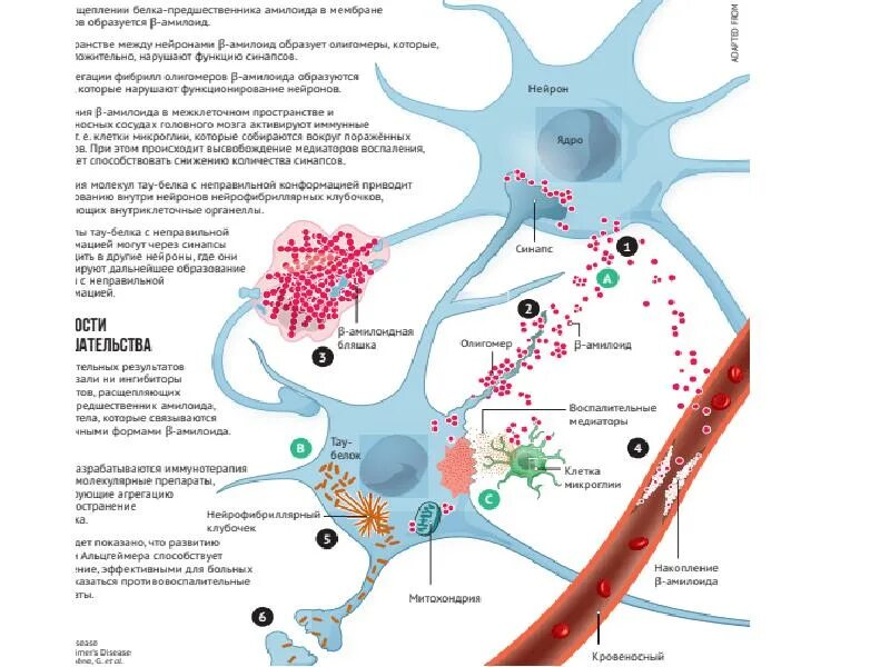 Болезнь альцгеймера этиология. Болезнь альцгеймера этиология. Сенильная деменция альцгеймеровского типа синдромы. Болезнь альцгеймера патогенез. Болезнь альцгеймера механизм развития.
