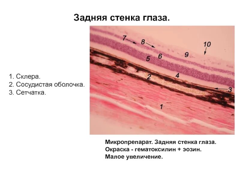 Задний полюс глаза. Задняя стенка глаза гистология сосудистая оболочка. Задняя стенка глаза (сетчатка). Окраска гематоксилин-эозином.. Сетчатка гистология препарат. Слои склеры гистология.