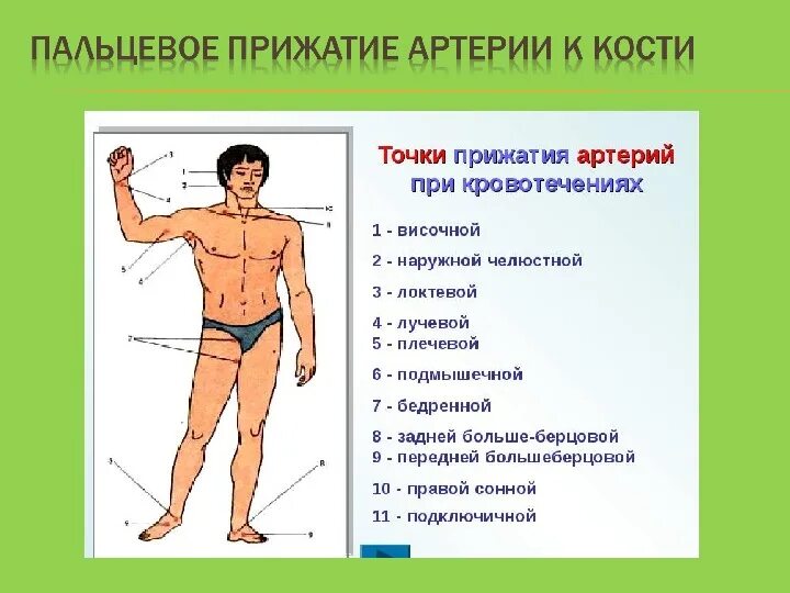 Способы остановки кровотечения пальцевое прижатие артерии. Точки пальцевого прижатия артерий. Места пальцевого прижатия артерий. Основные точки прижатия артерий. Точки пальцевого прижатия артерий для остановки кровотечения.