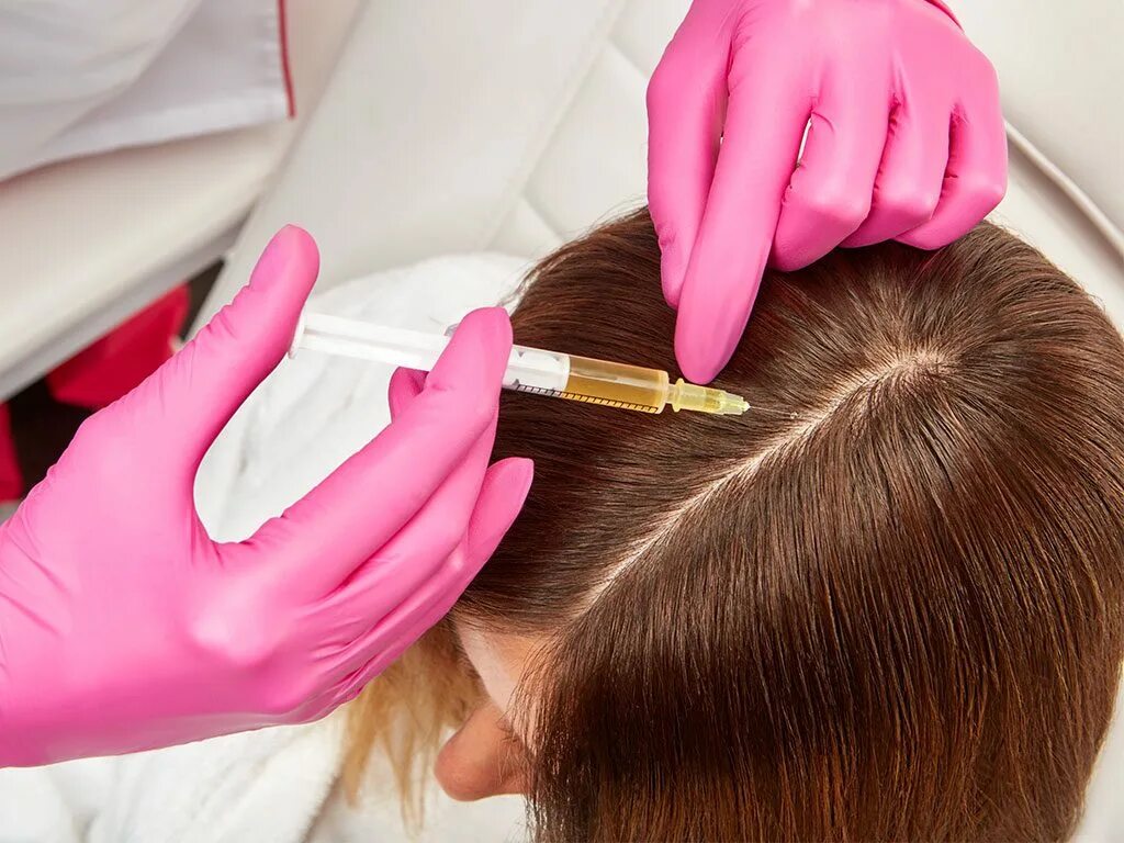 Инъекции головы. PRP плазмотерапия для волос. Плазмолифтинг для волос. Мезотерапия для волос. Мезотерапия волосистой части головы.