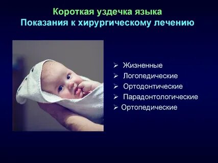 Уздечка форум