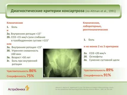 Коксартроз по келгрену