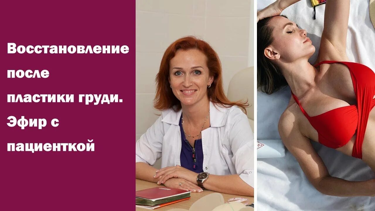 Маммопластика реабилитация отзывы. Реабилитация после пластики груди. маммопластика операция. редукционная маммопластика. маммопластика после грудного вскармливания.