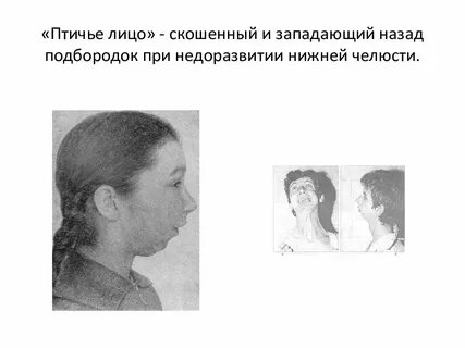 Всегда напряженное лицо