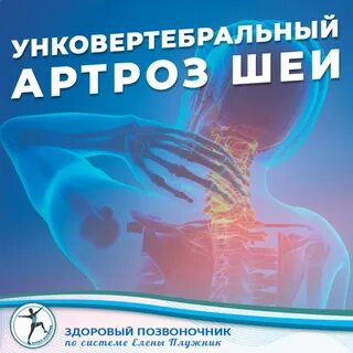 Артроз шейного отдела позвоночника лечение у женщин