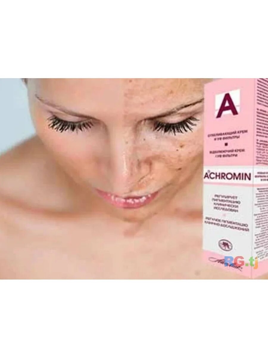 Отбеливающий крем для лица от пигментных пятен ахромин. Крем ахромин до и после. Ахромин крем для лица отбеливающий 45мл. Ахромин от пигментных пятен до и после.