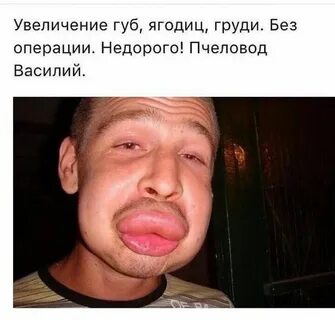 Накаченные губы прикол