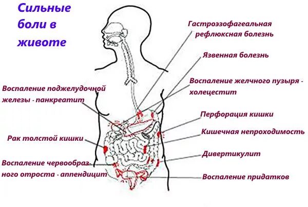 Сильно болит левая сторона живота снизу. Болит в нижней части живота слева. Болит слева внизу живота у мужчин. Резь в левой нижней части живота. Болит низ живота голова