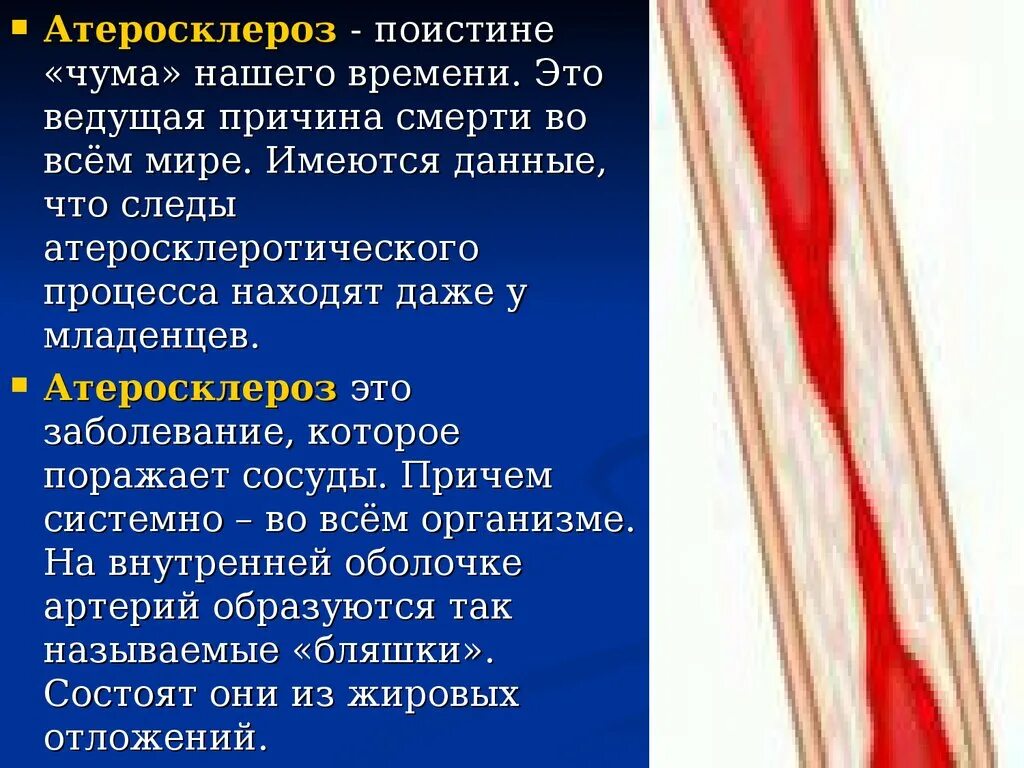 Ишемическая болезнь сосудов. Атеросклеротическая болезнь сердца. Атеросколетическая болезньсердца. Астеросклеротическаяболезнь сердца. ИБС атеросклеротический.