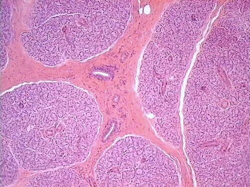 Околоушная железа гистология. Околоушная железа гистология препарат. Околоушная слюнная железа гистология препарат. Околоущная слюнная железа гематоклсилин Этзони. Препарат околоушной железы