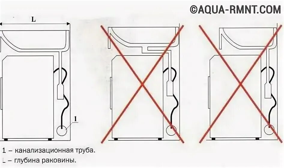 И установить ее между