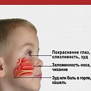 Постназальный затек у ребенка