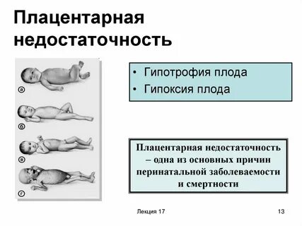 Нарушения плаценты