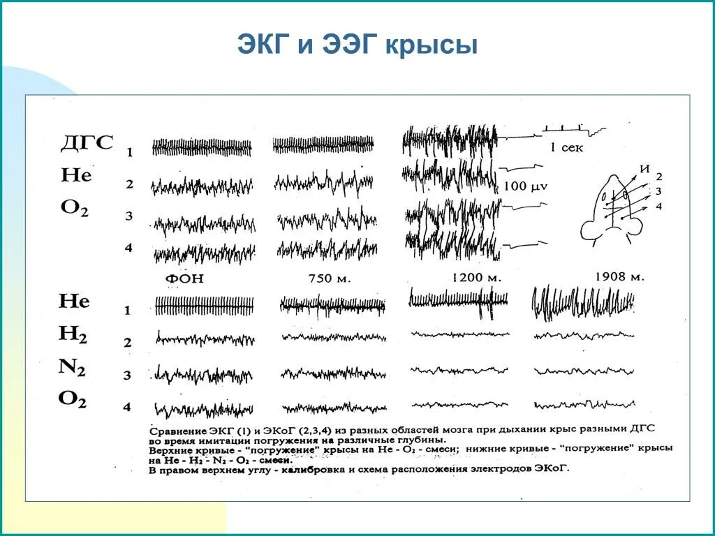 Чем отличается ээг от. Электроэнцефалография и электрокардиография (ЭЭГ И ЭКГ). Электроэнцефалограмма (ЭЭГ) электрокардиограмма (ЭКГ). ЭКГ ЭЭГ расшифровка. ЭКГ крысы.