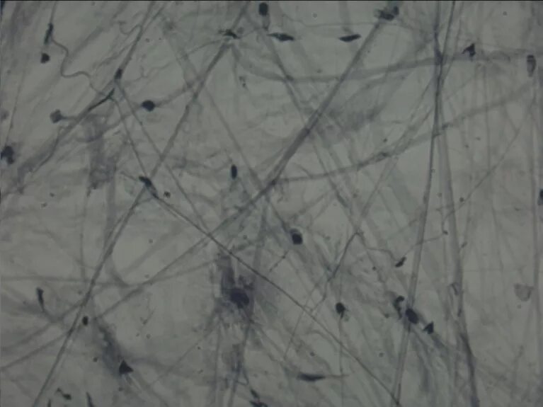 Волокнистая соединительная ткань гистология. Клетки волокнистой ткани. Клетки волокнистой ткани. Рыхлая соединительная ткань препарат. Рыхлая волокнистая соединительная гистология.