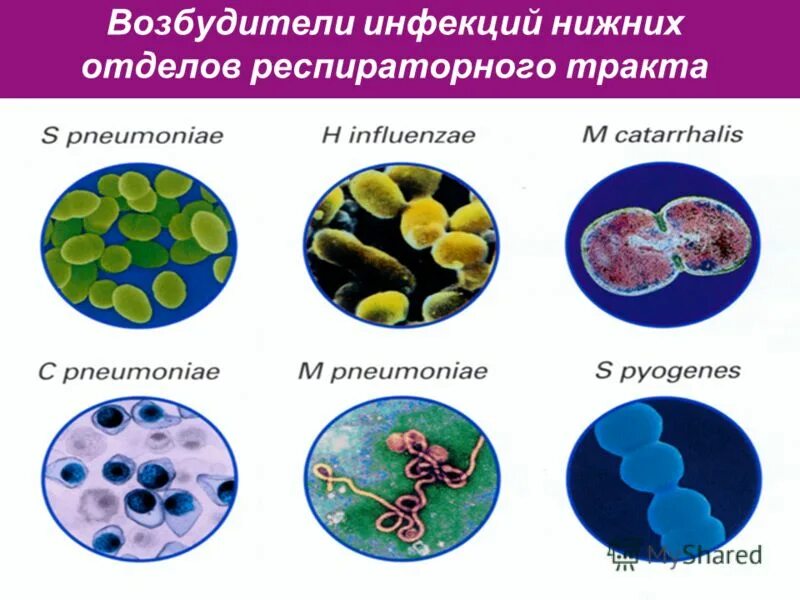 возбудительные инфекцыонныхзаболеваний. источник возбудителя инфекции. возбудители инфекционных болезней. классификация механизмов и путей передачи инфекции. классификация инфекционных заболеваний по источнику возбудителя.