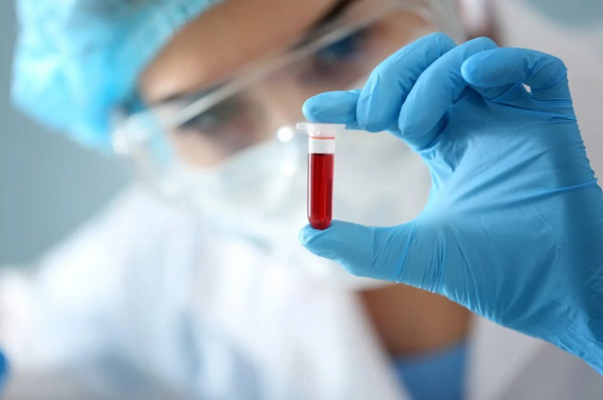 Анализ крови. Кровь медицина. Лабораторное обследование крови. Биохимические исследования. Гематология диагностика