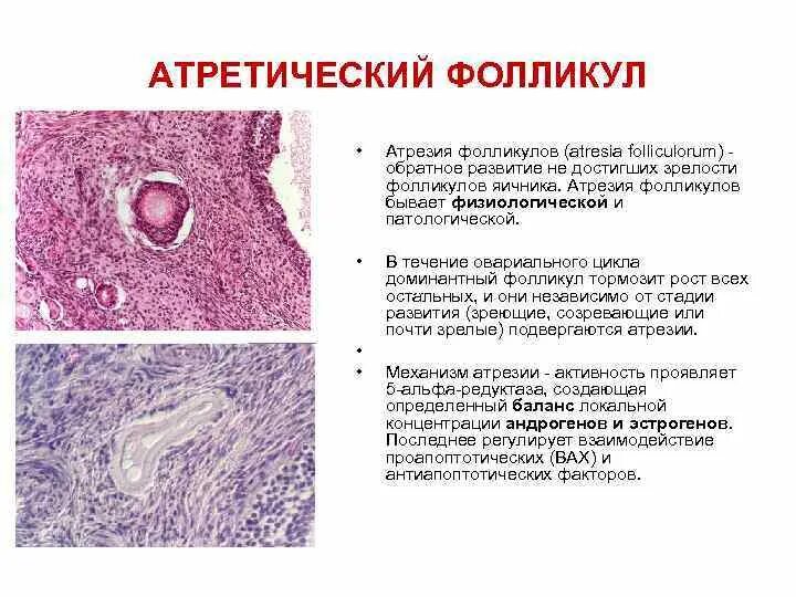 Атретическое тело яичника гистология. Атретический фолликул строение. Атрезия фолликула гистология. Атрезирующий фолликул гистология. Находится в фолликуле