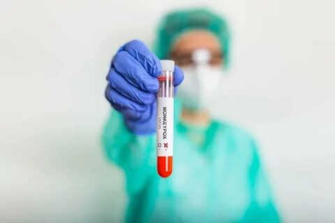 Вакцина от обезьяньей оспы