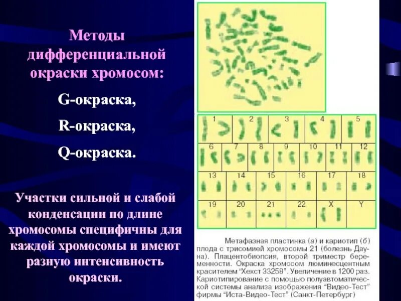 Изменение окраски хромосом. Методы дифференциальной окраски хромосом. Методы окраски хромосом. Методы дифференциального окрашивания хромосом. Метод дифференциальной окраски хромосом.