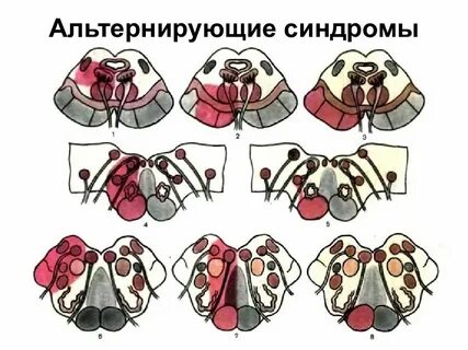 Альтернирующие вебера