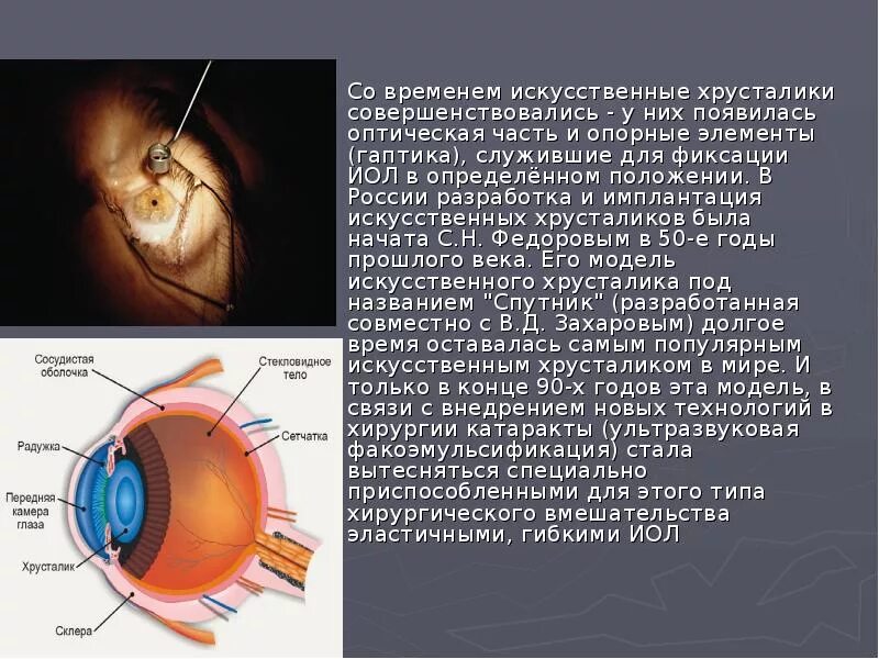 Практическая работа принцип работы хрусталика биология. Искусственный хрусталик. Искусственный хрусталик глаза. Имплантация искусственного хрусталика.