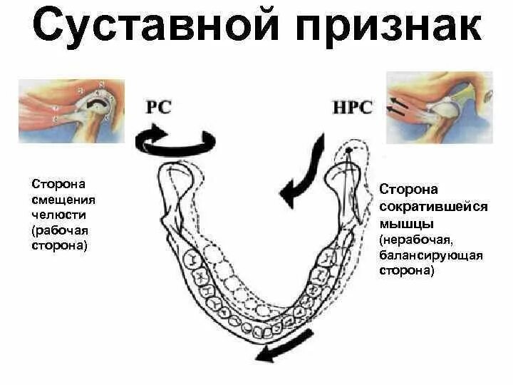 Окклюзия суставов