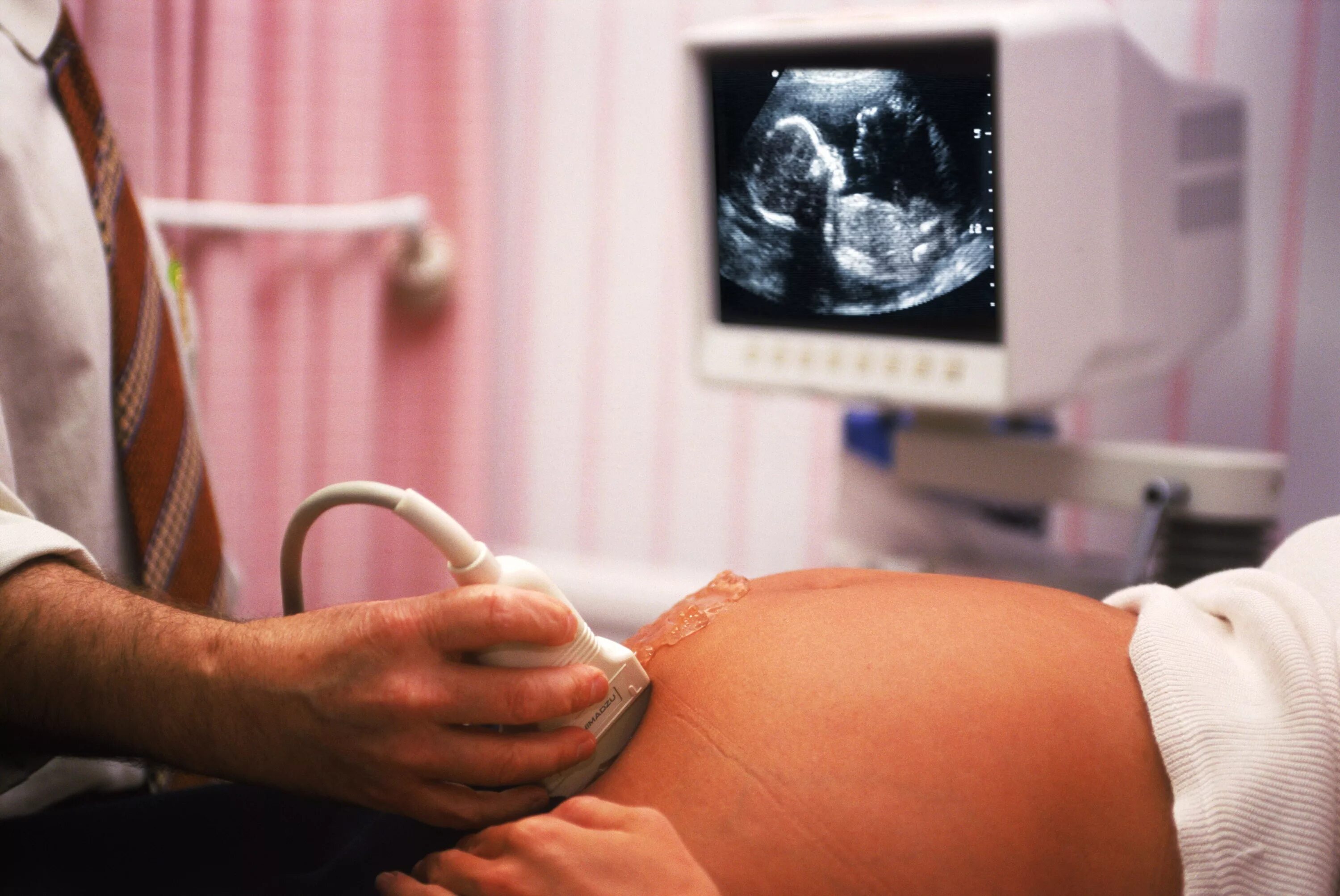 Узи первого триместра. Пренатальный скрининг 1 триместра беременности. Ультразвуковое исследование плода. УЗИ скрининг.