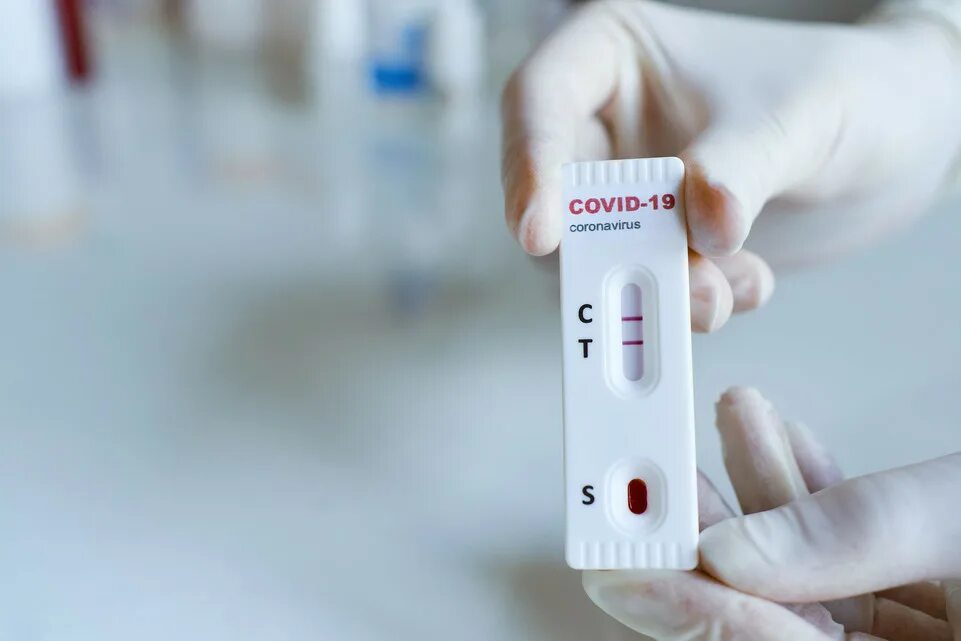 Rapid testing. Rapid test covid19. covid-19 antigen rapid test. экспресс-тест на covid-19 antigen rapid test kit. covid 19 test.