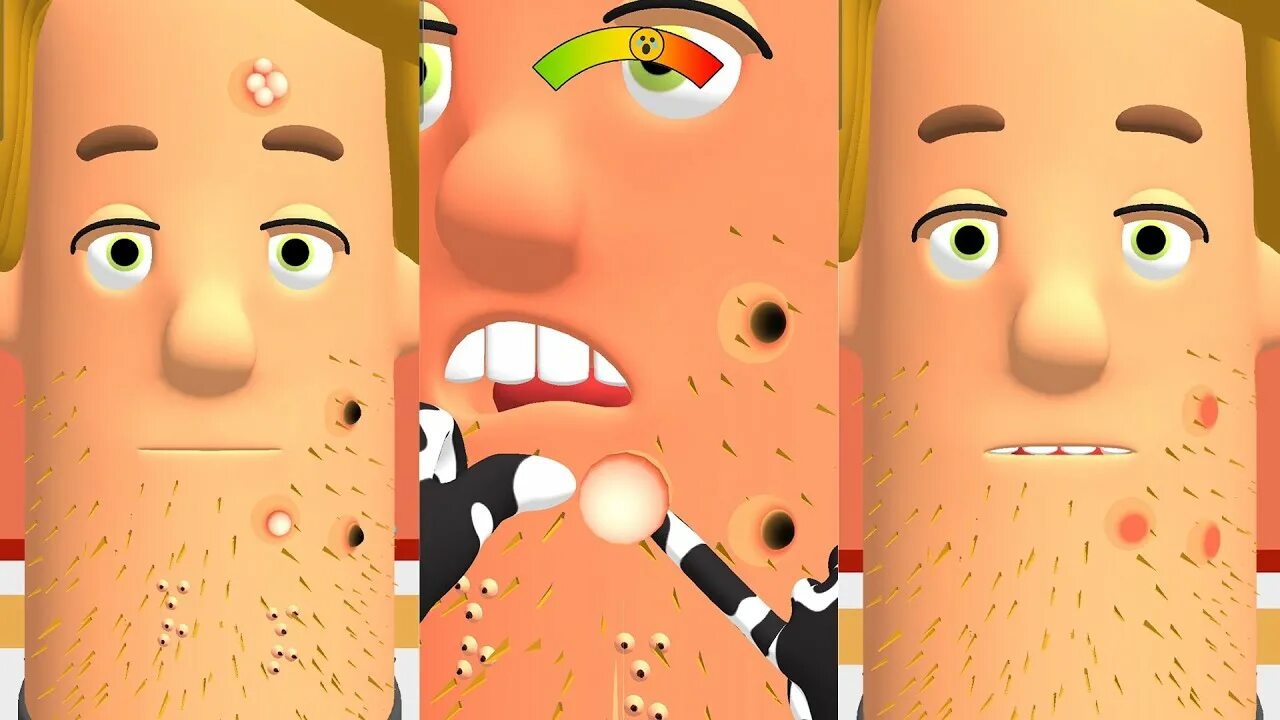 Доктор угрей