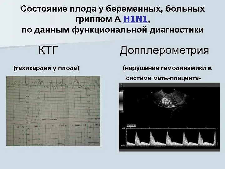 Тахикардия при беременности в третьем триместре. Причины тахикардии плода. Тахикардия при беременности 3. При синусовой тахикардии диастола. При беременности тахикардия лекарства.