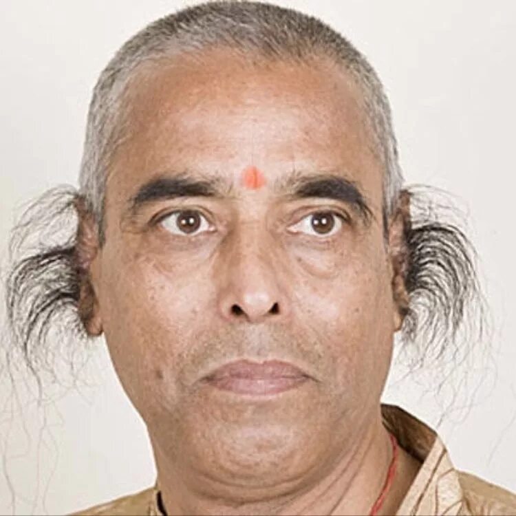 Гипертрозия ушной раковины. Гипертрихоз ушей. Мальчик с волосатым лицом. Гипертрехоз ушные раковины. Гипертрихоз ушей.