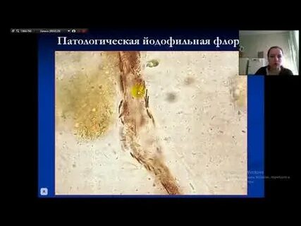Йодофильная в кале у взрослого