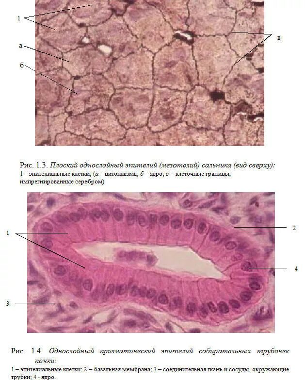 Однослойный плоский мезотелий. Однослойный плоский эпителий препарат гистология. Мезотелий сальника препарат гистология. Однослойный плоский эпителий мезотелий сальника препарат. Однослойный плоский эпителий мезотелий препарат.