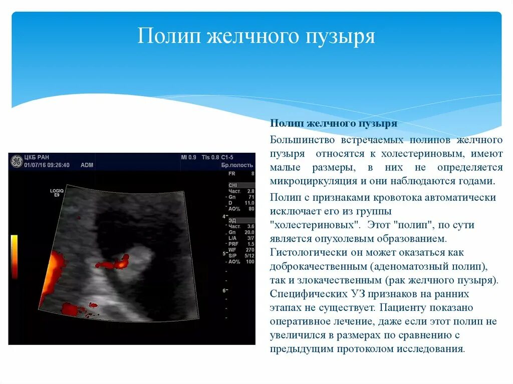 Определение сократимости желчного пузыря