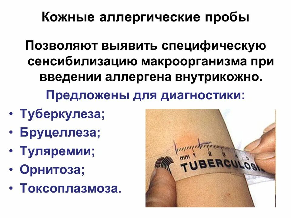 Положительный результат пробы. Постановка кожно аллергических проб это метод. Кожно-аллергические пробы иммунология. Кожно аллергическая проба туляремия. Кожные аллергические пробы.