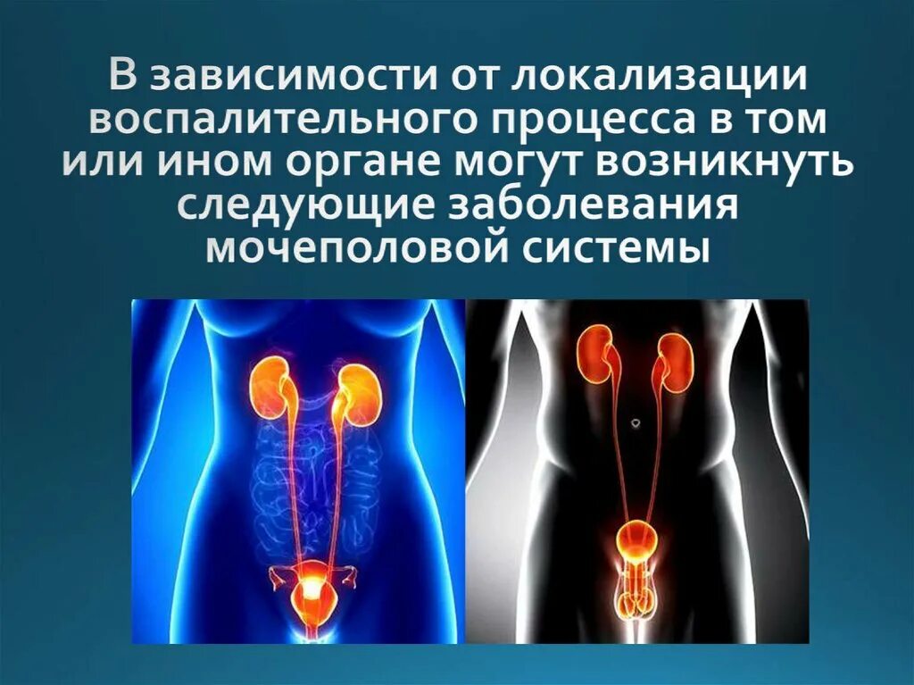 Заболевания мочеполовой системы. Заболевания мужской мочеполовой системы. Неспецифические воспалительные заболевания мочеполовой системы. Мочеполовая система женщины.