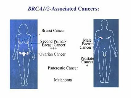 Brca1 2