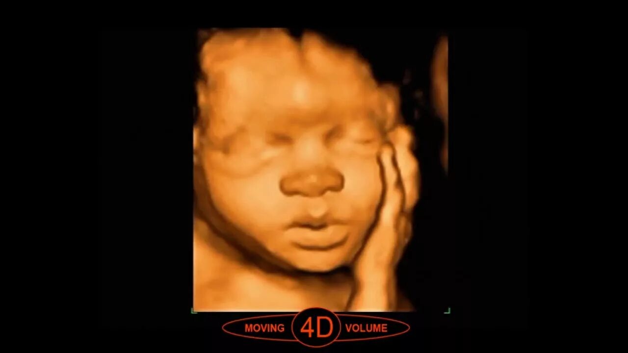 Чем отличается узи от 3д узи. Чем отличается узи от 3д узи. Узи 4д в третьем триместре беременности. 3 скрининг 3д узи при беременности. 4д узи 3 триместр москва.