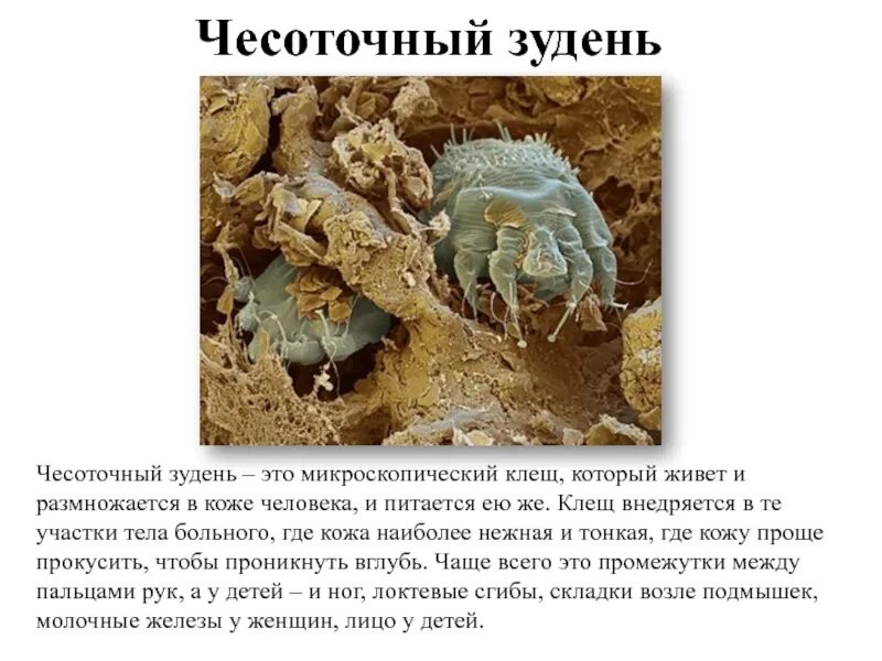 Чесоточный зудень хелицеры. Чесоточный зудень систематика. Самка чесоточного зудня. Чесоточный зудень систематика. Чесоточный зудень систематика.