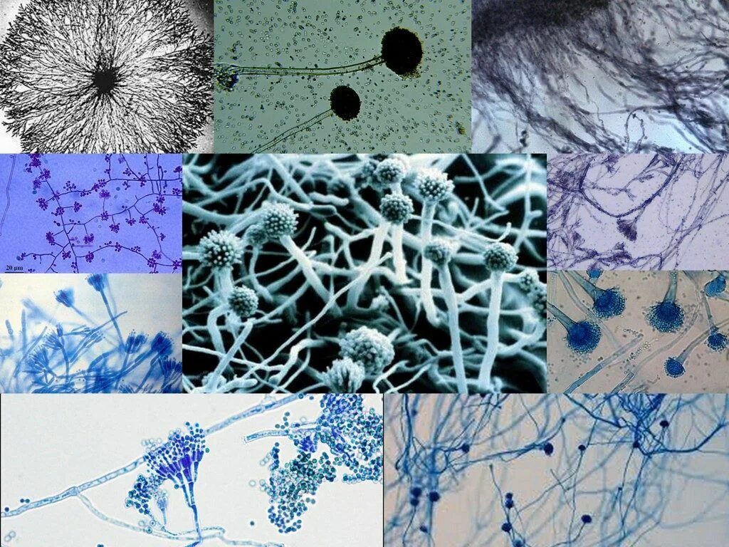 Обнаружены споры и мицелий. Мицелий и псевдомицелий. Мицелий грибов микроскопия. Микоз кожи микроскопия. Грибы кандида микроскопия.