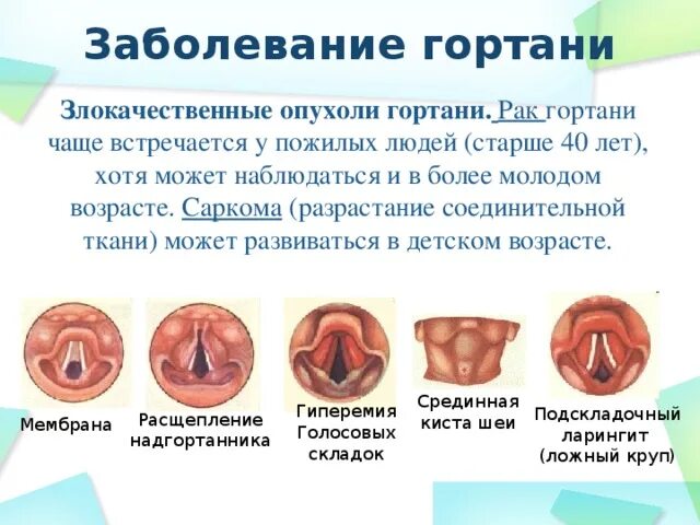Фотографии золотистого стафилококка на гландах Вдали от цивилизации Фотогалерея 