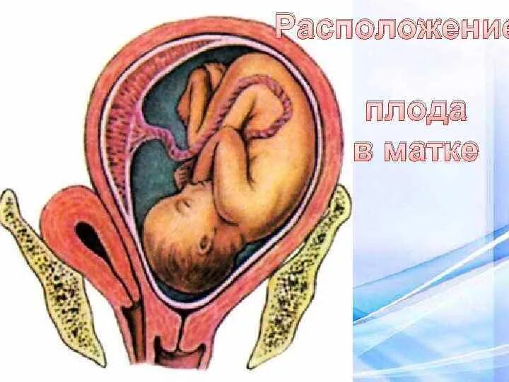 2 матки беременность