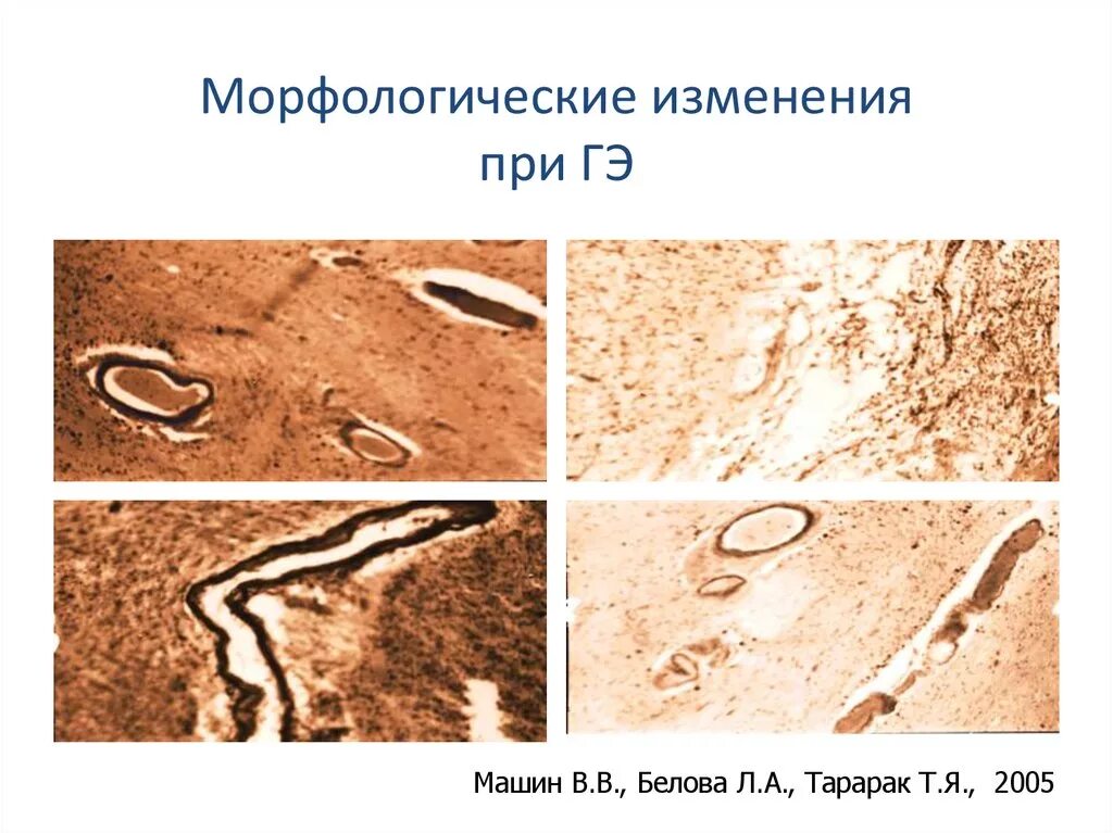 Морфологические изменения организма это. Морфологические изменения. Морфологические изменения человека это.