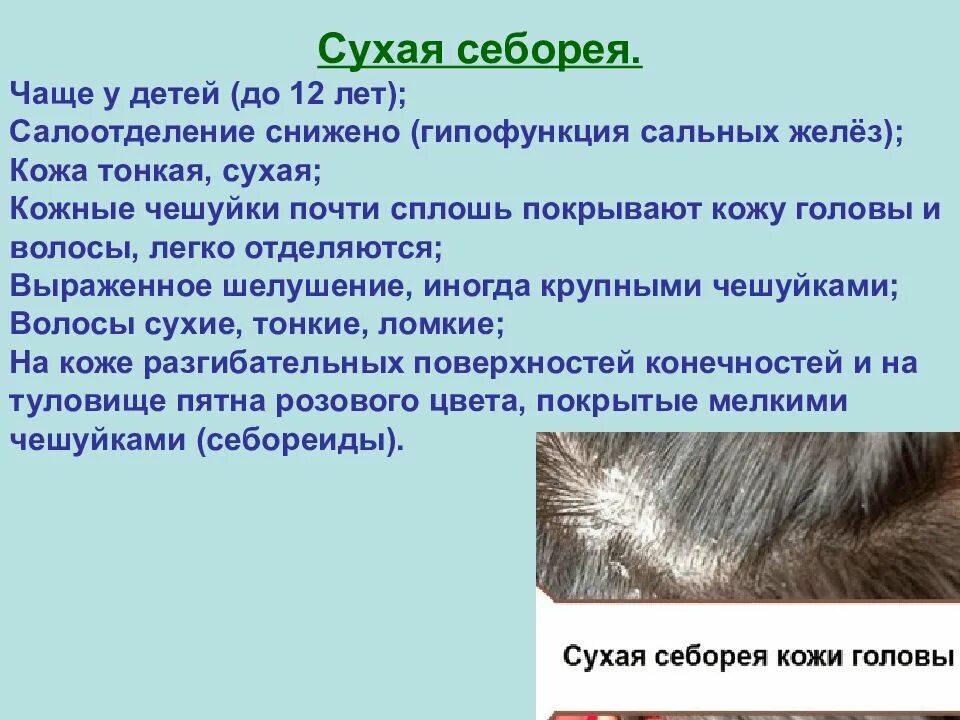 Как отличить сухой. Себорейный дерматит возбудитель. Себорейный дерматит чешуйки. Себорейный дерматит трихология. Себорейный дерматит вычесывание.