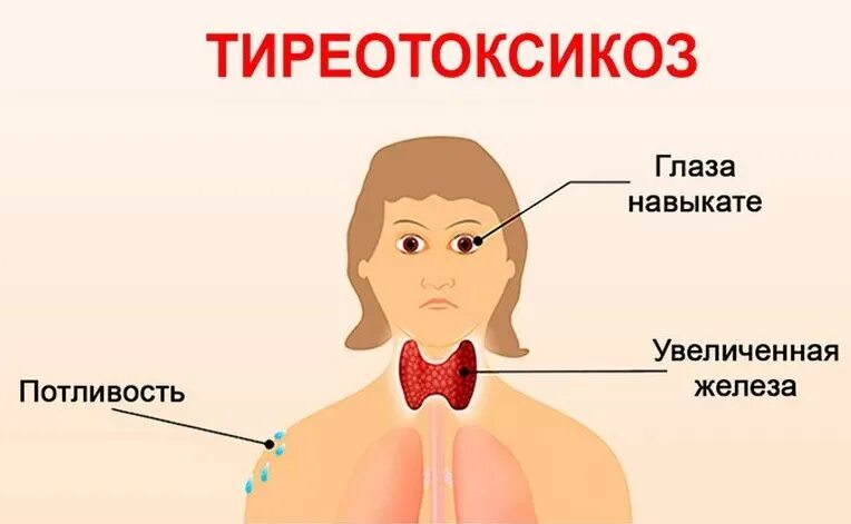 Кот с гипертиреозом как выглядит Гипертиреоз кто от него полнел фото презентация