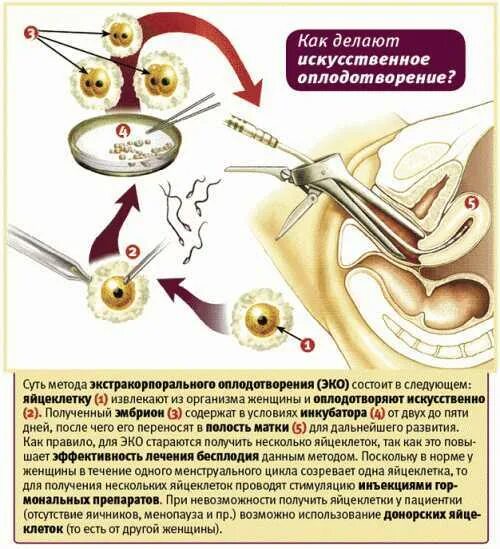 Процесс за которым следует оплодотворение. Экстракорпоральное оплодотворение схема. Оплодотворение яйцеклетки эко. Оплодотворение яйцеклетки ИКСИ. Эко это искусственное оплодотворение.