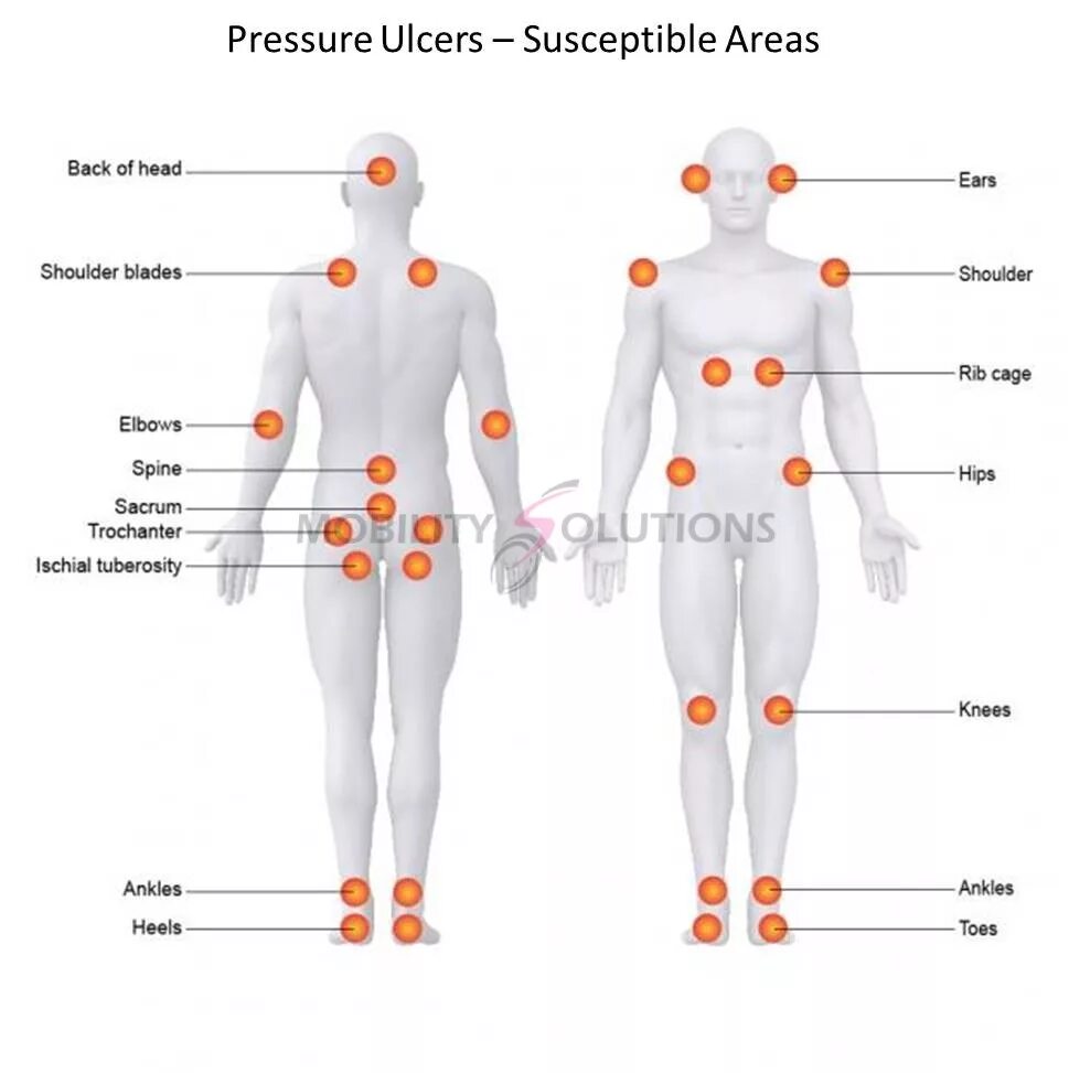 Back area. Head Pressure. Pressure points Band.